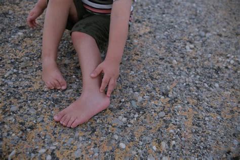 Dengue en niños cuáles son los riesgos y qué síntomas son de alarma