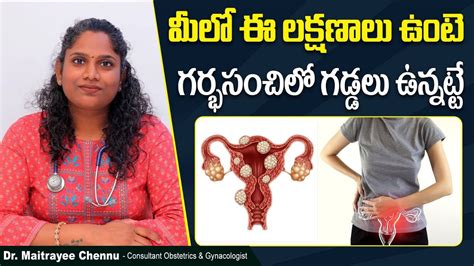 గరభసచల గడడలక కరణల Symptoms and Treatment of Uterine