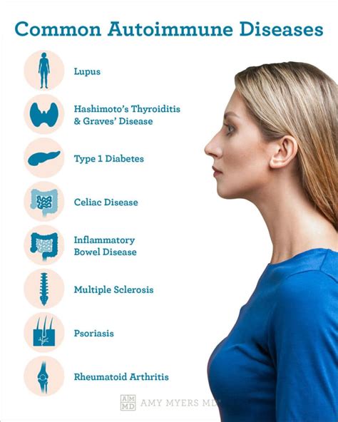 List of common autoimmune diseases – Artofit