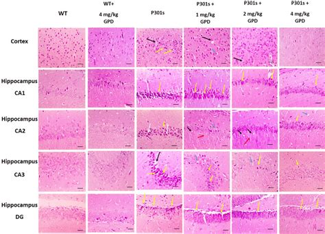 Effect Of GPD Treatment On Tauopathy Induced Histopathological Changes