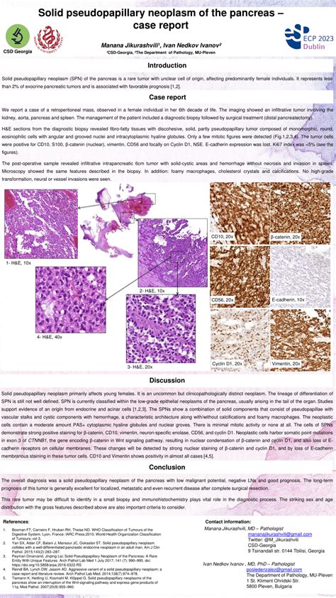 Pdf Solid Pseudopapillary Neoplasm Of The Pancreas Case Report