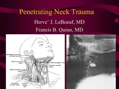 Ppt Penetrating Neck Trauma Powerpoint Presentation Free Download Id 814417