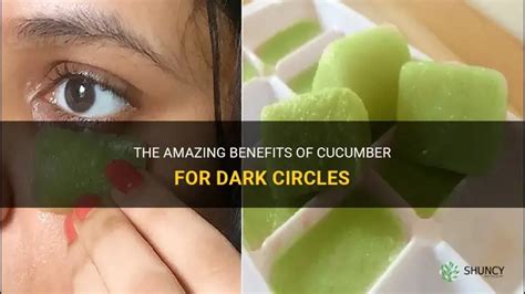 The Amazing Benefits Of Cucumber For Dark Circles | ShunCy