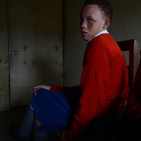 Living With Albinism In Uganda Dana Ullman