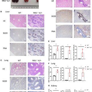 Gc B Cell Specific C Myc And Bcl Expression Produces Dlbcl Phenotype