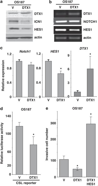 Deltex1 Dtx1 Negatively Regulates Notch1 Hes1 Signaling And Download Scientific Diagram