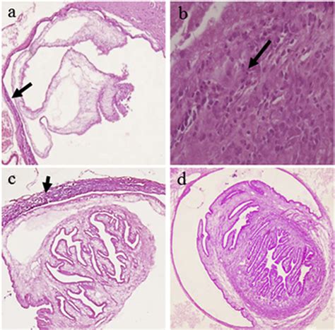 Hematoxylin And Eosin H E Stained Microphotographs Of Taenia Solium