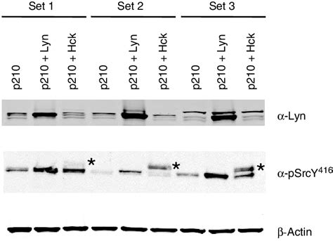 Stable Overexpression Of Lyn And Hck In Ba F3 Bcr Abl P210 Cells