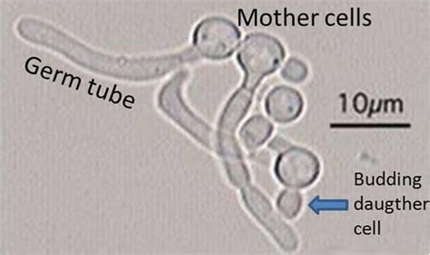 Germ Tube Test Principle Procedure Results Interpretation And Limitations