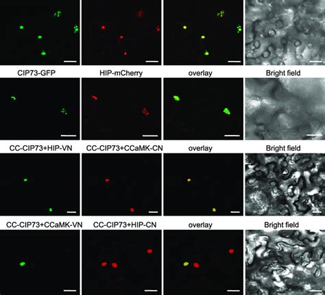 Co Localization Of Cip Hsc Hsp Interacting Protein Hip And