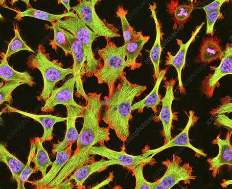 Cultured Hela Cells Light Micrograph Stock Image G4420321 Science