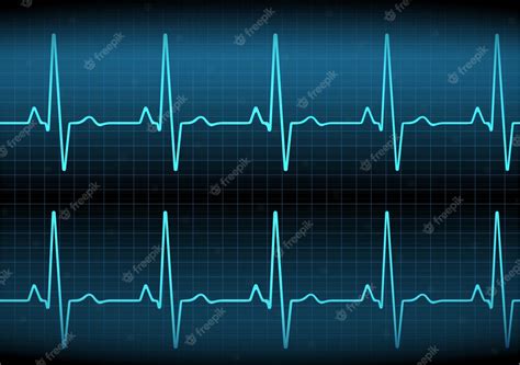 Gráfico De Frecuencia Cardíaca Latido Del Corazón Icono De Ekg Onda Color Turquesa Ilustración