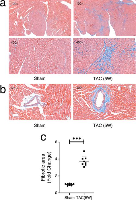 Chronic Pressure Overload Induced Cardiac Fibrosis A And B