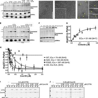 Coronin B Dissociates The Arp Complex From The Sides Of Actin