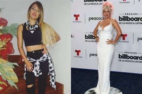 Karol G Plastic Surgery And Pregnancy Rumors Truth Unveiled