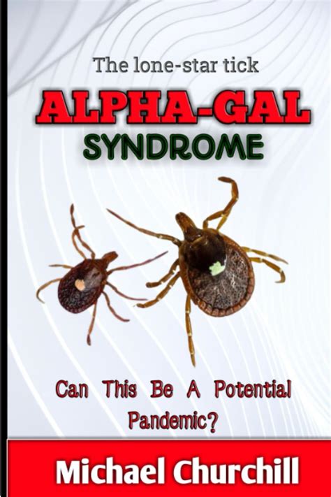 The Lone Star Tick Alpha Gal Syndrome Can This Be A Potential Pandemic