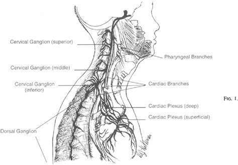 Figure I from Transient Horner's Syndrome in a Trauma Patient with Thoracic Epidural Analgesia ...