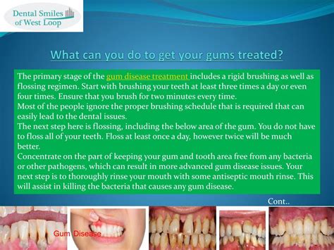 PPT - Gum Disease Treatment: How you can Eradicate the gum Disease