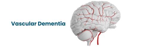 What Are The Symptoms And Causes Of Vascular Dementia