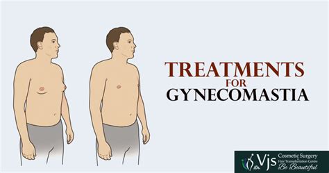 What Is The Best Treatment For Gynecomastia Sound Health Doctor