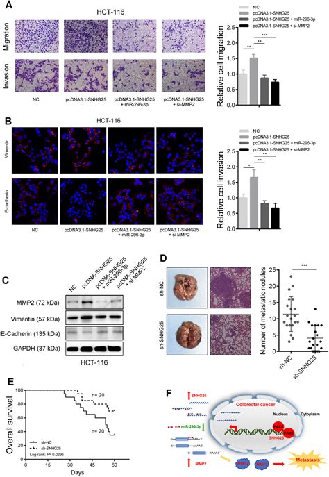 SNHG25 Promotes Colorectal Cancer Metastasis By Regulating MMP2 Aging