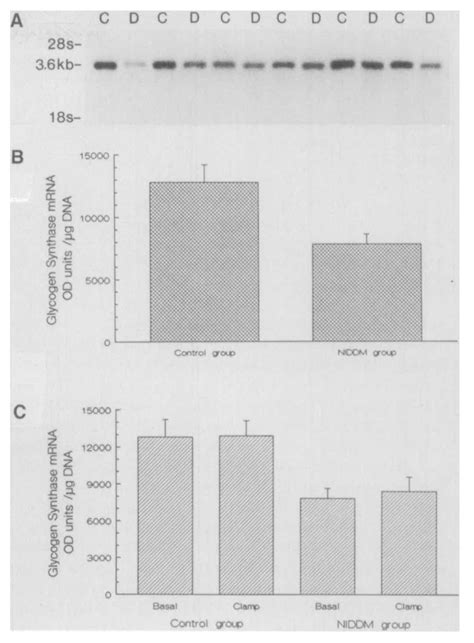 A Northern Blot Analysis Of Glycogen Synthase Mrn A Levels In Skeletal