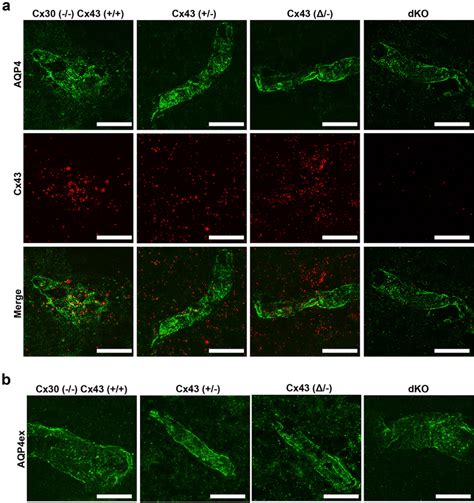 Distribution Of Cx43 Aqp4 And Aqp4ex In Brain Sections From Cx43