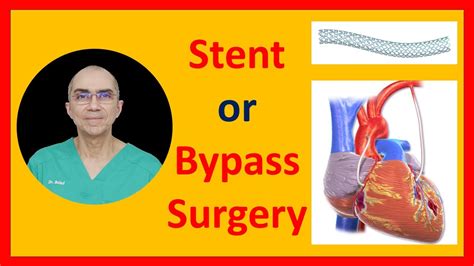 Stent Or Bypass Surgery Youtube