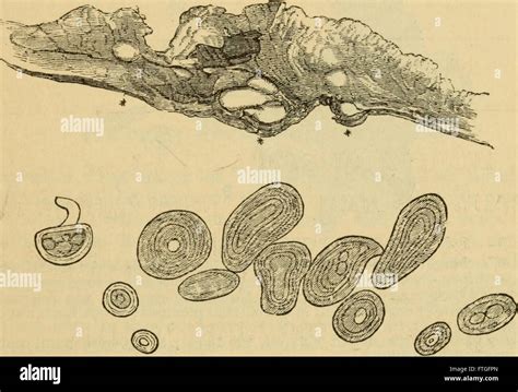 Pathological anatomy hi-res stock photography and images - Alamy