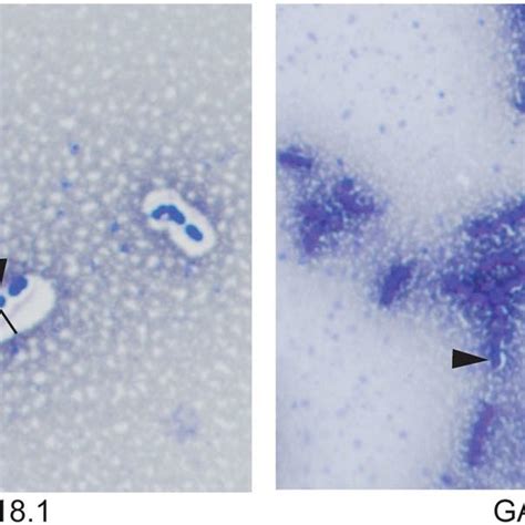 Capsule Staining Of Gas Bacterial Smears Were Stained With Indian Ink