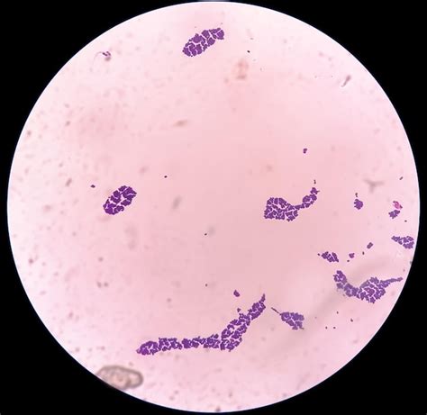 Tinci N De Gram Bajo Vista Microsc Pica Que Muestra Colonia De Candida