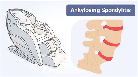 Massage Chair For Ankylosing Spondylitis