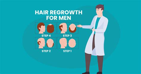 Mens Hair Loss Treatment Perth Restore And Regrow Hair Today