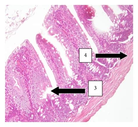 H E Stained Sections Of The Small Intestines At X Magnification A