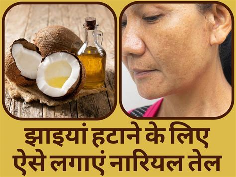 Nariyal Tel Se Jhaiya Kaise Hataye नारियल तेल में ये 3 चीजें मिलाकर