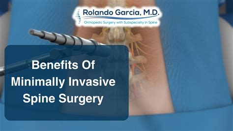 Benefits Of Minimally Invasive Spine Surgery Dr Rolando Garcia Jr