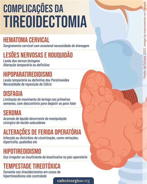 10 Complicações da Tireoidectomia O que pode dar errado na Cirurgia de