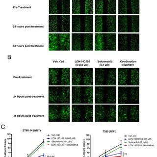 Selumetinib Enhances The Anti Migratory Effects Of Ldn In Mpnst