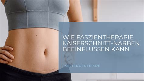 Wie Faszientherapie Kaiserschnitt Narben Beeinflussen Kann Chiron Center