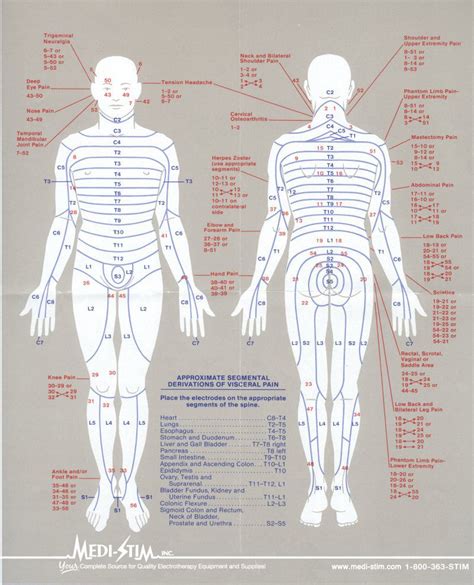 Tens Unit Placement Diagram