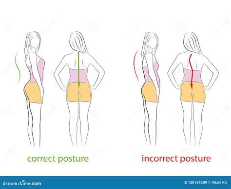 Postura Correta E Incorreta Lado E Vista Traseira Recomendações Médicas