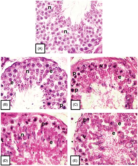 Microphotographs Of Testicular Tissue Showing Histopathological