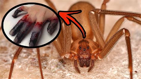 Brown Recluse Spider 10 Facts You Should Know Youtube