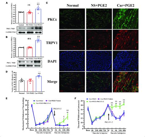 Protein kinase C epsilon PKCε in the dorsal root ganglion DRG