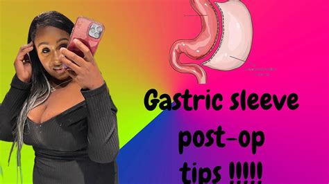 I Had The Gastric Sleeve Tips And Warnings ⚠️‼️ Youtube