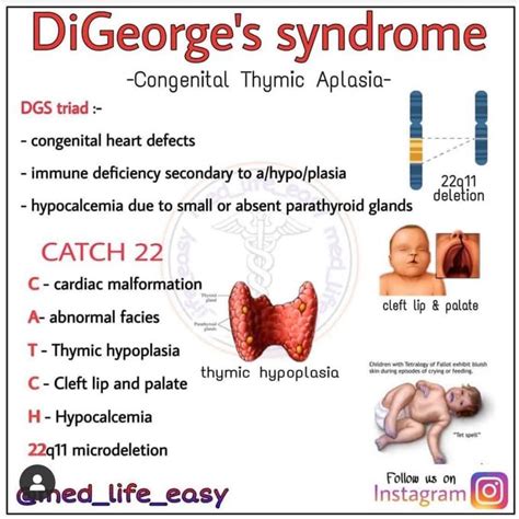 Catch 22 Syndrome Mnemonic - Captions Lovers