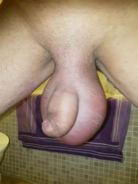 Liter Saline Im Sack Free Gay Porn E XHamster