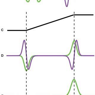 (PDF) Mach bands explained by response normalization