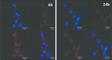 Confocal Microscopy Images Of Caco Rods Uptaken By Cancer Cells After