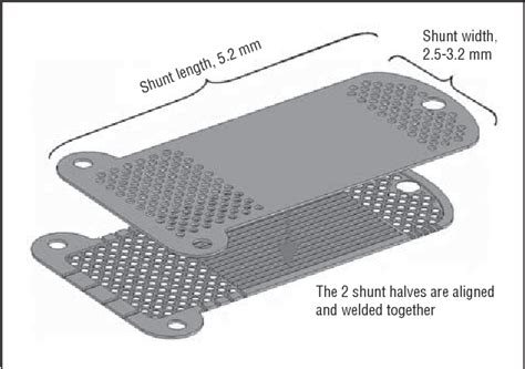 Figure From Efficacy And Safety Of Gold Micro Shunt Implantation To